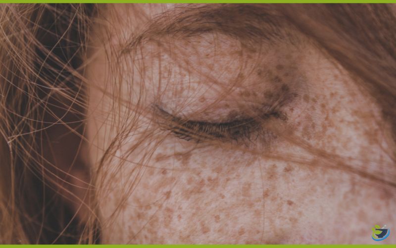 4. درمان مشکلات پوستی با فلفل سیاه